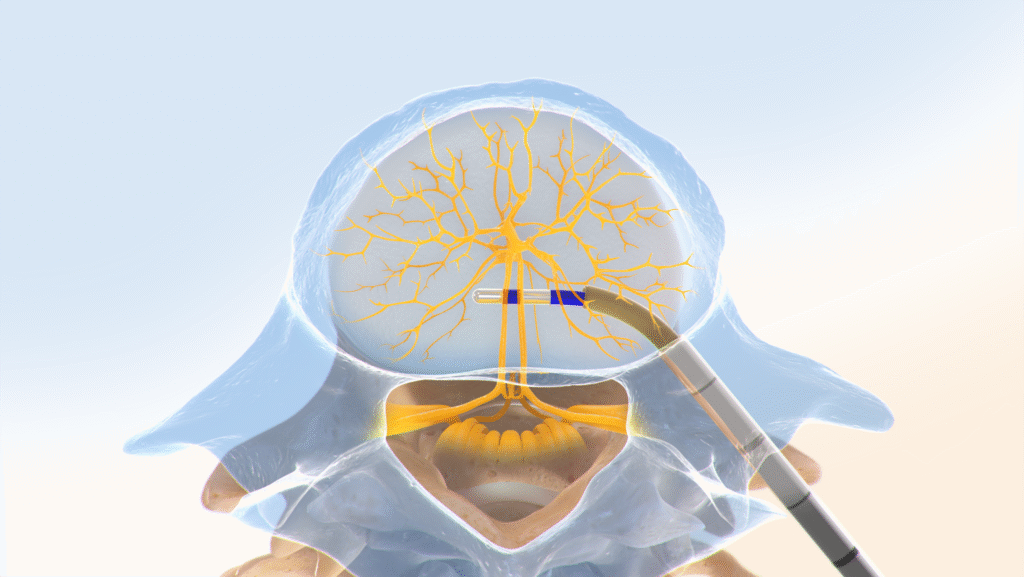 pain management overland park