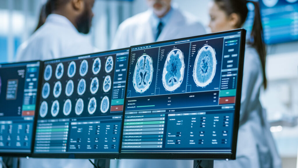 mri after a car accident