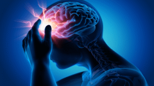 vagal nerve stimulation concussion