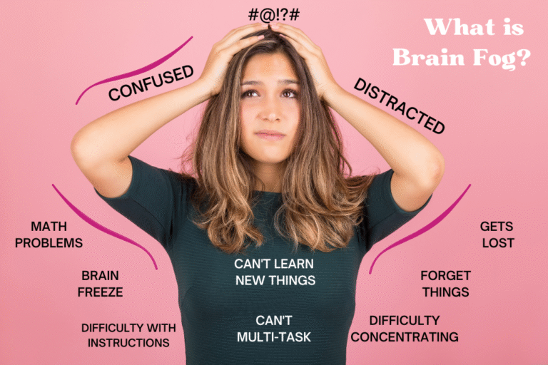 brain fog concussion