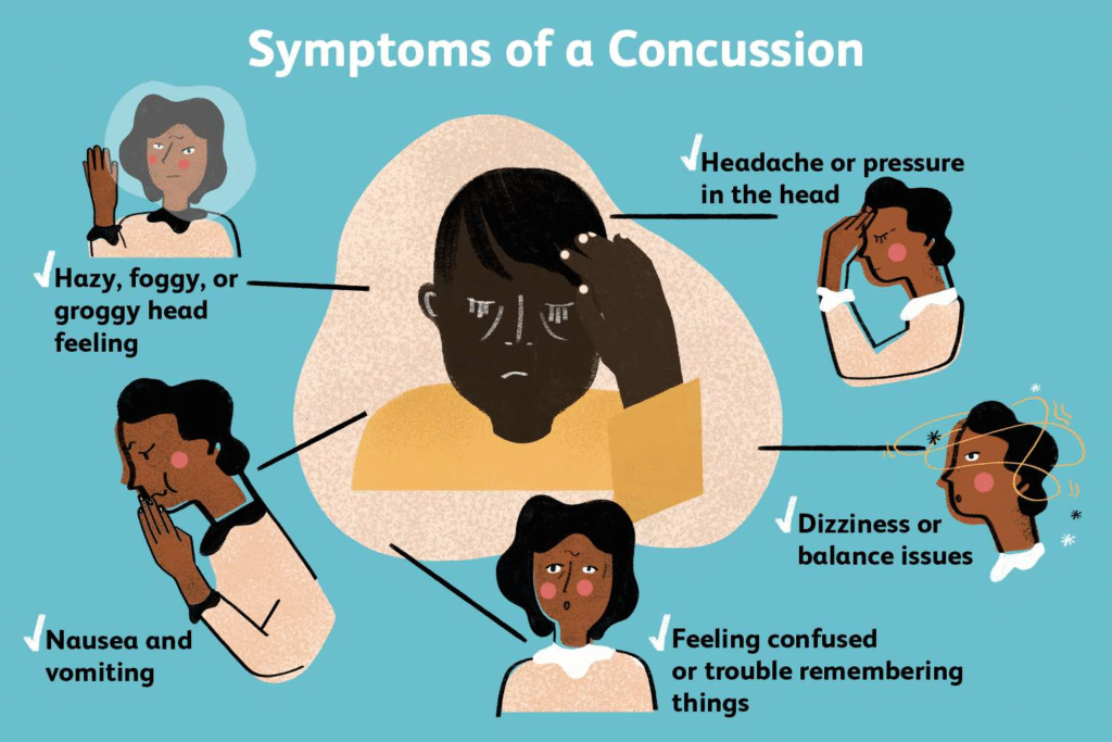 concussion symptoms after a car accident